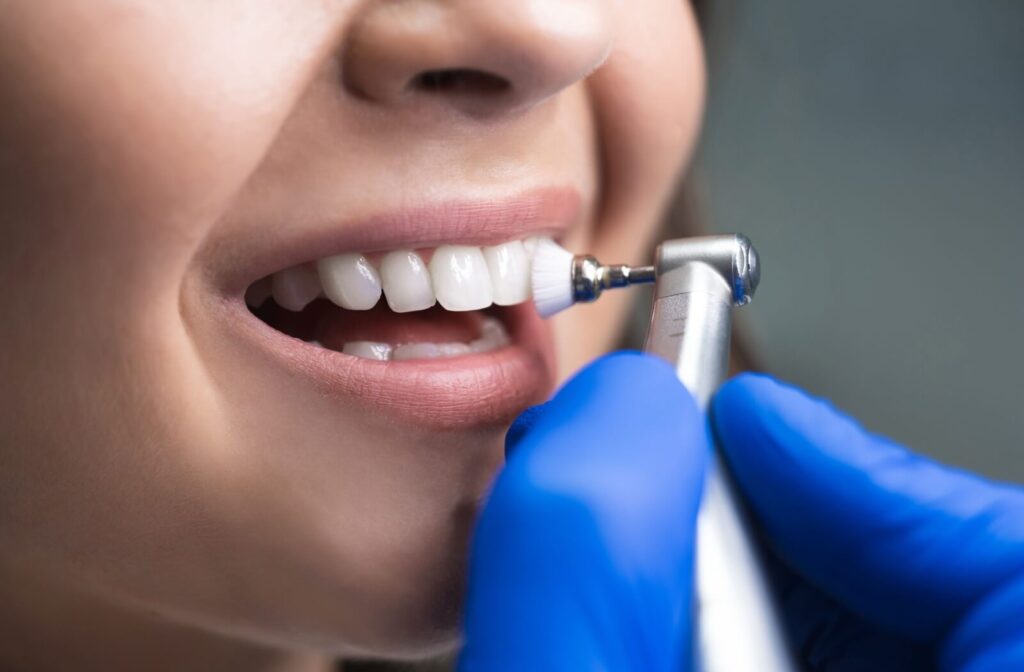 Close-up of teeth being polished with a dental cleaning brush.