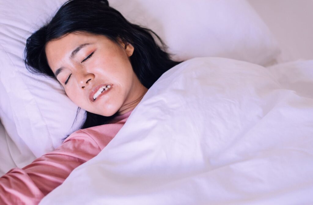 Young woman lying in bed under a white blanket, clenching her teeth in her sleep, illustrating nighttime teeth grinding.