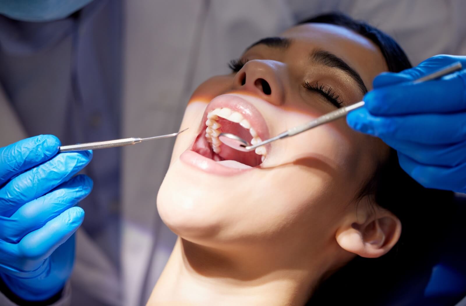 Dentist performing a dental recall exam on a patient. The dentist is using dental instruments to check the patient's teeth for cavities and other oral health issues.